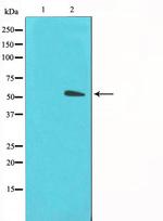 GLUT3 Polyclonal Antibody