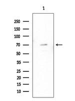 HDAC10 Antibody in Western Blot (WB)
