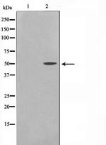 Cytokeratin 16 Antibody in Western Blot (WB)