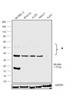 Melan-A Antibody in Western Blot (WB)