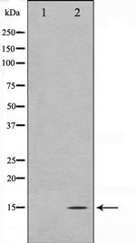 Melan-A Antibody in Western Blot (WB)