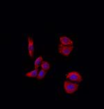 MMP11 Polyclonal Antibody