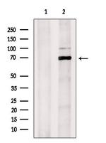 MMP15 Antibody in Western Blot (WB)