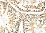 MMP23 Antibody in Immunohistochemistry (Paraffin) (IHC (P))