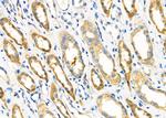 NME2 Polyclonal Antibody