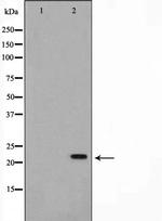 NME2 Antibody in Western Blot (WB)