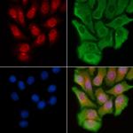 PCAF Polyclonal Antibody