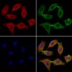 DCTN2 Polyclonal Antibody