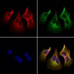 PTH Polyclonal Antibody