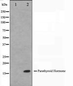 PTH Antibody in Western Blot (WB)