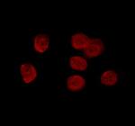 RCBTB1 Polyclonal Antibody