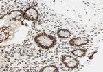 RCBTB1 Antibody in Immunohistochemistry (Paraffin) (IHC (P))