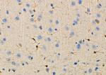 RCBTB1 Antibody in Immunohistochemistry (Paraffin) (IHC (P))