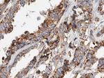 gamma Synuclein Polyclonal Antibody