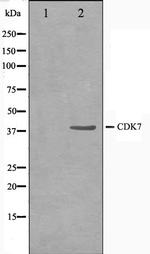 CDK7 Antibody in Western Blot (WB)