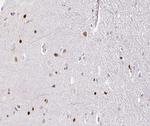 TOP2B Antibody in Immunohistochemistry (Paraffin) (IHC (P))