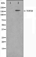 TOP2B Antibody in Western Blot (WB)