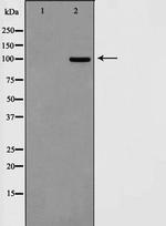 SAPAP1 Polyclonal Antibody