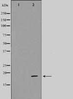 CDK2AP1 Polyclonal Antibody