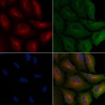 TP53I11 Polyclonal Antibody