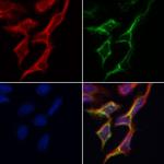 TP53I11 Antibody in Immunocytochemistry (ICC/IF)