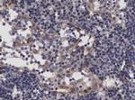 TP53I11 Antibody in Immunohistochemistry (Paraffin) (IHC (P))