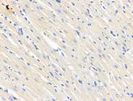 TP53I11 Antibody in Immunohistochemistry (Paraffin) (IHC (P))