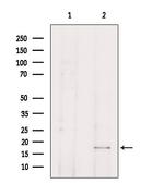 TP53I11 Antibody in Western Blot (WB)