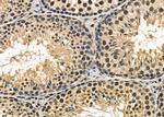 KLF11 Antibody in Immunohistochemistry (Paraffin) (IHC (P))