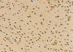 KLF11 Antibody in Immunohistochemistry (Paraffin) (IHC (P))