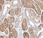 MID1 Polyclonal Antibody