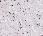MED14 Polyclonal Antibody
