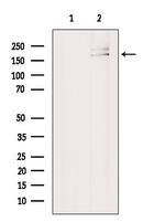 MED14 Antibody in Western Blot (WB)