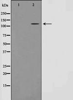 ST18 Polyclonal Antibody