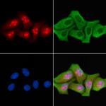 TBX10 Polyclonal Antibody