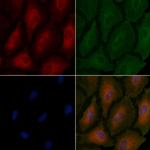 TSPAN8 Antibody in Immunocytochemistry (ICC/IF)