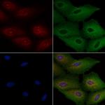 TSPAN8 Polyclonal Antibody