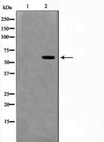 MUTYH Polyclonal Antibody