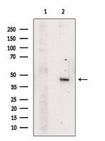 FOXH1 Polyclonal Antibody