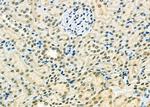 ETV4 Polyclonal Antibody