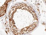 DCLK3 Antibody in Immunohistochemistry (Paraffin) (IHC (P))