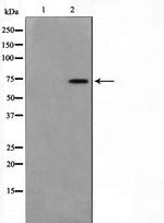 MED17 Polyclonal Antibody
