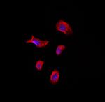 TACC1 Polyclonal Antibody