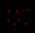 ZNF498 Polyclonal Antibody