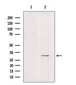 ZNF498 Antibody in Western Blot (WB)