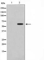 CYP26A1 Polyclonal Antibody