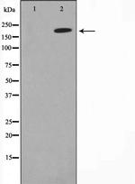 MAGI2 Polyclonal Antibody