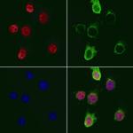 SUPT3H Polyclonal Antibody
