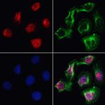 VPS72 Polyclonal Antibody