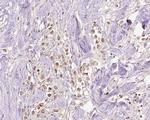 VPS72 Antibody in Immunohistochemistry (Paraffin) (IHC (P))